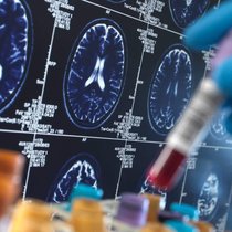 L'industrie biotechnologique a fait d'énormes progrès ces dernières années, notamment en oncologie.