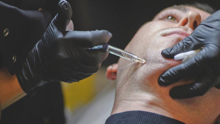 Injecté sous forme de gel, l’acide hyaluronique repulpe les lèvres, sculpte les pommettes ou lisse les rides.