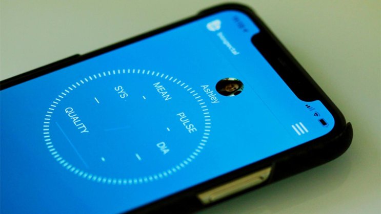 La solution mesure la pression artérielle avec la caméra d'un smartphone.