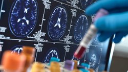 L'industrie biotechnologique a fait d'énormes progrès ces dernières années, notamment en oncologie.