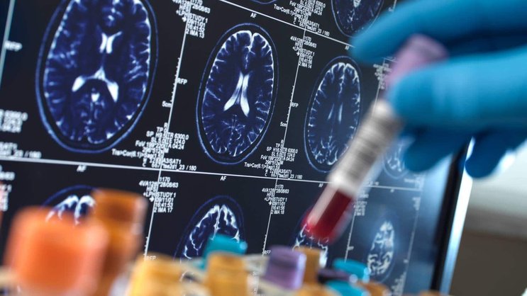 L'industrie biotechnologique a fait d'énormes progrès ces dernières années, notamment en oncologie.